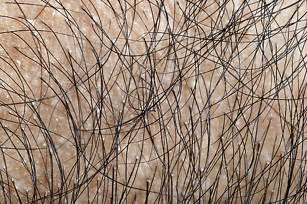 포토 JPG 해외이미지 근접촬영 신체부위 뷰티 머리카락 머리 두피 두피관리 두피케어 탈모 탈모클리닉 해외202004 두피검사 탈모예방 해외포토 뷰포인트 사람 검사_조사 예방 클리닉 헤어관리 증상 파일형식 이미지허브