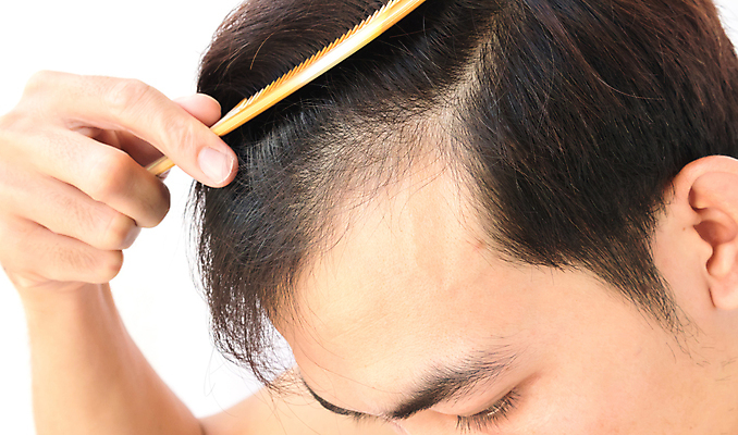 포토 JPG 해외이미지 손 남자 한명 들기 상반신 성인 신체부위 뷰티 머리카락 머리빗 흰배경 헤어관리 두피관리 두피케어 탈모 탈모클리닉 성인남자한명만 해외202004 탈모예방 숱 해외포토 1 백그라운드 모션 사람 머리 흰색 미용용품 예방 클리닉 증상 남자한명만 성인남자만 파일형식 이미지허브