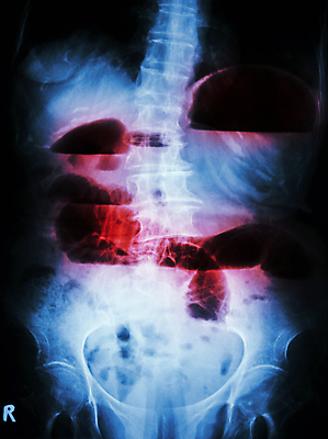 포토 JPG 해외이미지 과학 신체 해부 엑스레이 건강 병원 사람 사람없음 빨간색 약 검은색 고통 환자 의사 광선 흰색 수술 질병 X 작음 큼 시스템 외과 돌봄 염증 해외202004 해외포토 알파벳 감정 컬러 의학 모션 치료 의료진 크기 파일형식 이미지허브