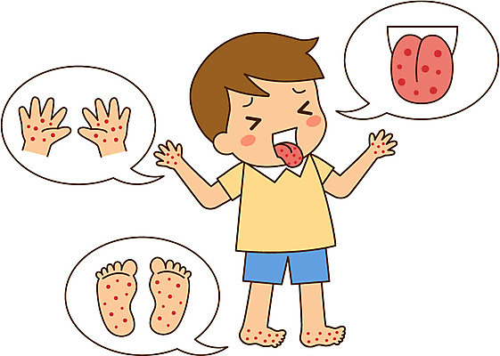 전신 남자 어린이 일러스트 한명 서기 질병 예방 수두 예방접종 수족구병 국내일러스트 AI파일 1 의학 모션 사람 전염병 접종 파일형식 벡터