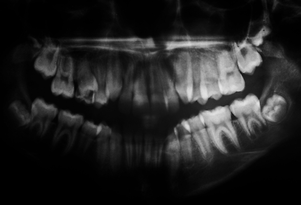 포토 JPG 해외이미지 직업 남자 산업 과학 백그라운드 패턴 부분 해부 뼈 엑스레이 건강 병원 사람 사람없음 컴퓨터 약 머리 검은색 고양이 장비 시험 환자 의사 광선 흰색 투명 조직 그룹 치아 X 필름 치과의사 돌봄 해골모형 해외202004 해외포토 알파벳 교육 컬러 무늬 포유류 의학 모션 신체부위 전자제품 반려동물 모형 의료진 소화기관 파일형식 이미지허브