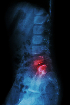 포토 JPG 해외이미지 어린이 신체 해부 뼈 골격 엑스레이 건강 병원 사람 사람없음 옆모습 고통 환자 의사 광선 질병 X 허리 척추 관절염 외과 고립 궤 돌봄 염증 요통 정형외과 해외202004 해외포토 알파벳 감정 뷰포인트 의학 모션 신체부위 의료진 허리통증 파일형식 이미지허브