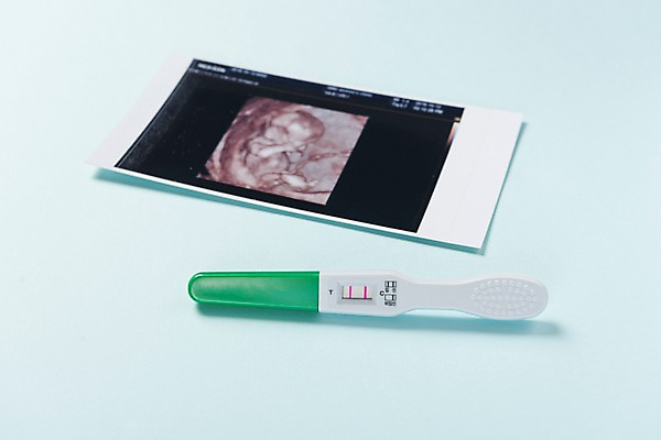 포토 JPG 스튜디오촬영 실내 사람없음 아기용품 임신테스트기 초음파사진 국내포토 내부 임신 의료용품 오브젝트 파일형식