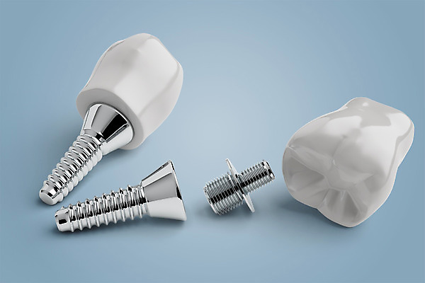 PSD 편집이미지 치과 사람없음 3D소스 3D 치아 디지털합성 합성 치아모형 나사못 임플란트 치아건강 편집3D 건강 병원 못 소화기관 파일형식