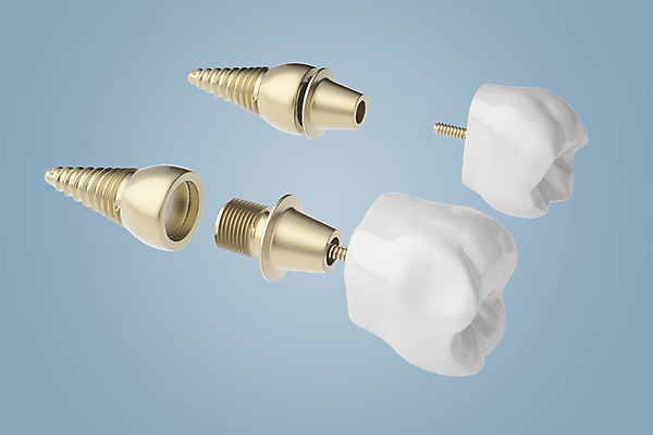 PSD 편집이미지 치과 사람없음 3D소스 3D 치아 디지털합성 합성 치아모형 나사못 임플란트 치아건강 편집3D 건강 병원 못 소화기관 파일형식