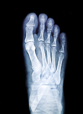 포토 JPG 해외이미지 남자 과학 신체 해부 뼈 골격 엑스레이 건강 병원 사람 사람없음 야외 약 건강관리 시험 환자 의사 광선 투명 질병 X 필름 척추 그림 발가락 외과 발목 깨짐 돌봄 방사선 양발 해외202004 해외포토 알파벳 교육 컨셉 의학 모션 발 관리 의료진 파일형식 이미지허브