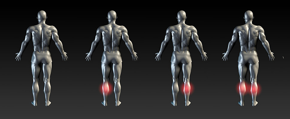 포토 JPG 해외이미지 의학 근육 엑스레이 건강 사람없음 빛 고통 종아리 물리치료 정형외과 치유 해외202004 해외포토 감정 병원 신체부위 치료 파일형식 이미지허브