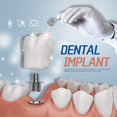 PSD 편집이미지 손 의학 한손 치과 주사기 신체부위 진료 치아 치아모형 치과진료 임플란트 잇몸 이미지편집 신체 의료기기 병원 사람 소화기관 파일형식