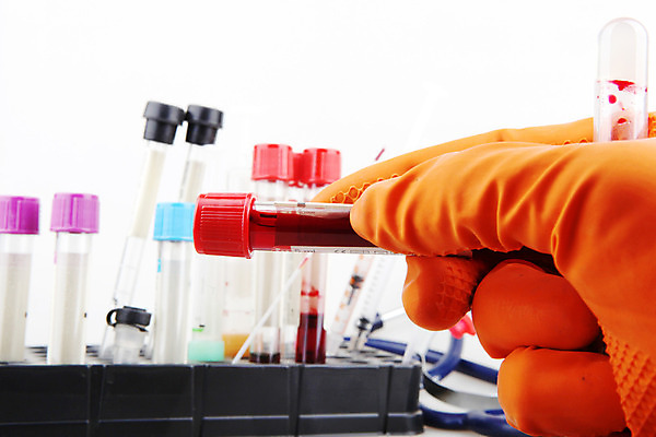 포토 JPG 해외이미지 접시 교육 백그라운드 건강 현미경 실험 사람 사람없음 초록색 스터디 약 장비 의사 기구 물방울 공구 업무 액체 떨어짐 생명공학 연구원 플라스틱 과학자 분석 측정 생물학 튜브 발견 조제 피펫 화학자 많음 해외202004 해외포토 직업 식기 컬러 과학 컨셉 의학 재질 실험기구 학습 의료진 도구 작업 만들기 학자 파일형식 이미지허브