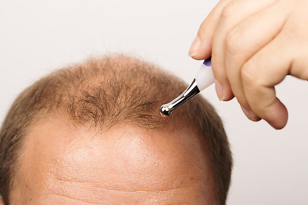 포토 JPG 해외이미지 손 남자 의료기기 한명 들기 근접촬영 성인 신체부위 뷰티 머리카락 머리 흰배경 두피관리 두피케어 탈모 탈모클리닉 성인남자한명만 해외202004 탈모예방 숱 해외포토 1 뷰포인트 백그라운드 의학 모션 사람 흰색 예방 클리닉 헤어관리 증상 남자한명만 성인남자만 파일형식 이미지허브