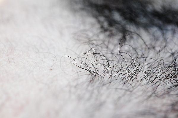 포토 JPG 해외이미지 근접촬영 사람없음 뷰티 머리카락 머리 두피 두피관리 두피케어 탈모 탈모클리닉 해외202004 두피검사 탈모예방 숱 해외포토 뷰포인트 신체부위 검사_조사 예방 클리닉 헤어관리 증상 파일형식 이미지허브