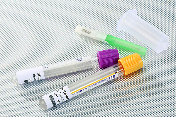 포토 JPG 해외이미지 건강 근접촬영 사람없음 바이러스 혈액검사 코로나바이러스 해외202004 해외포토 뷰포인트 의학 검사_조사 파일형식 이미지허브