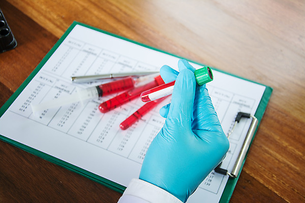 포토 JPG 해외이미지 여자 교육 남자 아시아 얼굴 컨셉 유리 건강 병원 실험 사람 동양인 성인 사람없음 파란색 약 장비 의사 코트 액체 실험실 DNA 생명공학 플라스크 분석 생물학 비커 유리그릇 발견 화학물질 화학자 해외202004 해외포토 그릇 나라 컬러 의학 재질 실험기구 인종 신체부위 외투 의료진 화학 과학자 파일형식 이미지허브