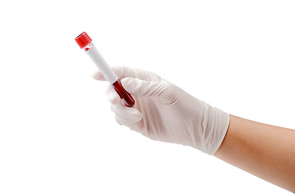 포토 JPG 해외이미지 손 장갑 건강 들기 신체부위 빨간색 약 의사 흰색 잡기 바이러스 질병 분석 시험관 혈액검사 코로나바이러스 해외202004 해외포토 잡화 컬러 컨셉 의학 모션 실험기구 사람 의료진 검사_조사 파일형식 이미지허브