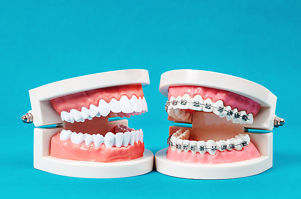 포토 JPG 해외이미지 모델 전통 백그라운드 건강 치과 병원 사람없음 치료 파란색 스터디 금속 거울 장비 흰색 대접 잡기 입 비교 실험실 치아 플라스틱 치과의사 클립 위치 외과 보험 틀니 철강 비용 해외202004 해외포토 컬러 컨셉 의학 모션 재질 실험 신체부위 경제 학습 의사 소화기관 파일형식 이미지허브