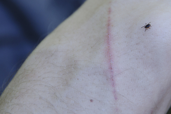 포토 JPG 해외이미지 동물 유럽 야생동물 곤충 자연 생물 사람없음 야외 빨간색 걷기 벌레 질병 위험 피부 감염 토막 기생충 해외202004 해외포토 나라 컬러 컨셉 의학 모션 신체부위 바이러스 생태계 파일형식 이미지허브