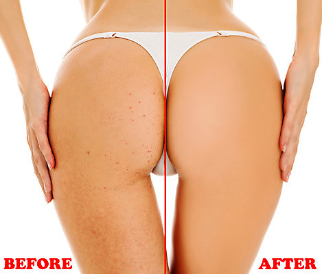 포토 JPG 해외이미지 모양 여자 다이어트 바닥 사람없음 숫자 화장품 마사지 속옷 몸무게 엉덩이 허리 피부 팬티 문제 당나귀 여드름 해로움 전후 셀룰라이트 해외202004 해외포토 문자 옷 컨셉 건강 사람 신체부위 뷰티 말_동물 비교 파일형식 이미지허브