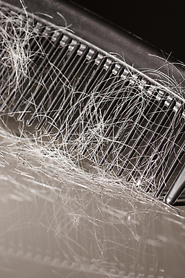 포토 JPG 해외이미지 검은배경 근접촬영 사람없음 뷰티 반사 머리카락 머리빗 헤어관리 두피케어 탈모 탈모클리닉 해외202004 탈모예방 숱 해외포토 뷰포인트 백그라운드 머리 검은색 미용용품 예방 클리닉 증상 파일형식 이미지허브