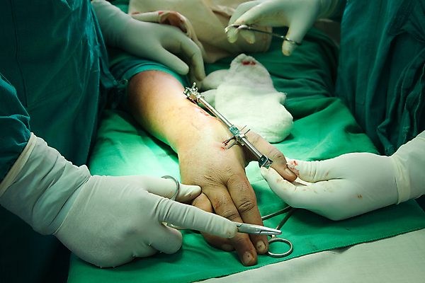 포토 JPG 해외이미지 직업 옷 포즈 노동자 실내 건강 병원 사람 사람없음 내부 치료 방 장비 간호사 의사 도구 대접 도움 수술 보호 집중 연습 확인 바쁨 외과 돌봄 위생관리 정형외과 주목 의료성형뷰티 해외202004 해외포토 컨셉 의학 모션 관리 의료진 파일형식 이미지허브