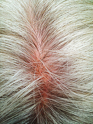 포토 JPG 해외이미지 노년 근접촬영 신체부위 뷰티 머리카락 머리 백발 헤어관리 두피 두피관리 두피케어 탈모 탈모클리닉 노인만 해외202004 탈모예방 숱 해외포토 헤어스타일 뷰포인트 사람 성인 예방 클리닉 증상 성인만 파일형식 이미지허브