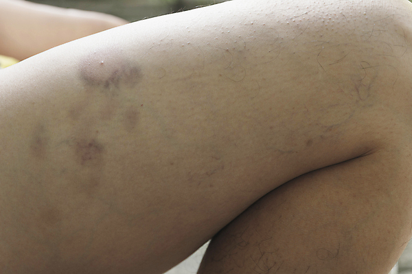 포토 JPG 해외이미지 백인 손 여자 스포츠 백그라운드 신체 근육 건강 사람 사람없음 빨간색 검은색 스트레칭 고통 흰색 마사지 질병 관절염 돌봄 염증 증상 해외202004 해외포토 서양인 감정 컬러 의학 모션 신체부위 운동 파일형식 이미지허브