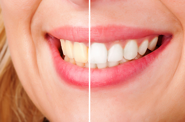 포토 JPG 해외이미지 여자 얼굴 건강 한명 미소 웃음 뷰티 화장품 흰색 입 치아 피부 입술 상아 틀니 미백 반가움 의료성형뷰티 해외202004 해외포토 1 감정 컬러 표정 사람 신체부위 소화기관 파일형식 이미지허브