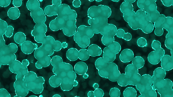 포토 JPG 해외이미지 공 불꽃 세포 사람없음 빛 거품 반지 광택 풍선 형광등 야광 방광 광 해외포토 장신구 불 전등 비뇨기관 파일형식 이미지허브