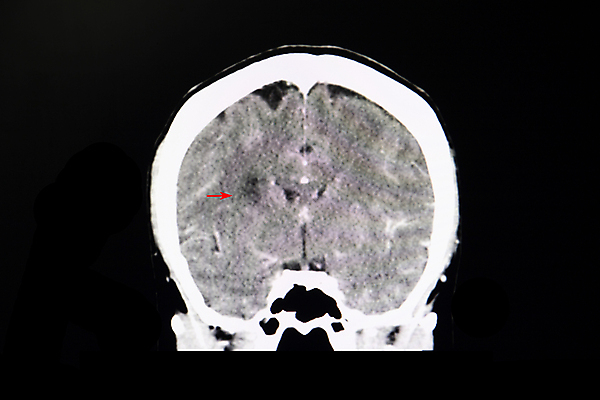 포토 JPG 해외이미지 해부 뼈 엑스레이 사람 사람없음 치료 컴퓨터 약 머리 검은색 고양이 환자 광선 긴급 질병 X 필름 뇌 외과 당뇨병 방사선 심각 타격 해골모형 해외포토 알파벳 컬러 컨셉 포유류 의학 모션 병원 신체부위 전자제품 반려동물 모형 파일형식 이미지허브