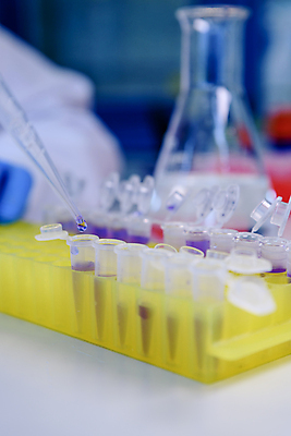 포토 JPG 해외이미지 과학 컨셉 건강 병원 실험 사람없음 스터디 약 장비 작업 액체 실험실 바이러스 질병 DNA 생명공학 플라스틱 약국 과학자 플라스크 분석 생물학 감염 미생물 튜브 발견 조제 혁명 개발 피펫 화학물질 화학자 살균 해외포토 직업 교육 의학 재질 생물 실험기구 학습 화학 만들기 학자 파일형식 이미지허브