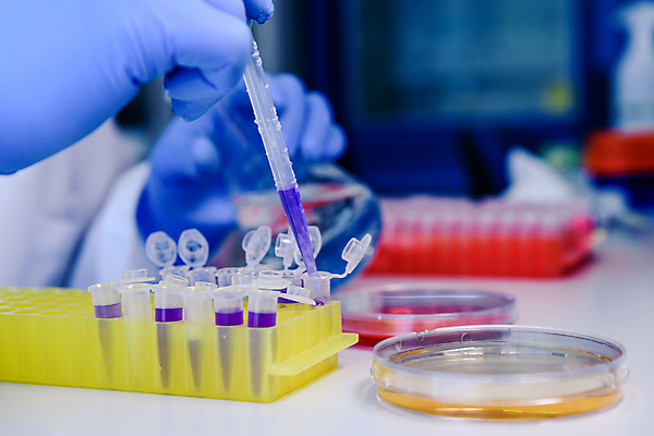 포토 JPG 해외이미지 과학 컨셉 건강 병원 실험 사람없음 스터디 약 장비 작업 액체 실험실 바이러스 질병 DNA 생명공학 플라스틱 약국 과학자 플라스크 분석 생물학 감염 미생물 튜브 발견 조제 혁명 개발 피펫 화학물질 화학자 살균 해외포토 직업 교육 의학 재질 생물 실험기구 학습 화학 만들기 학자 파일형식 이미지허브