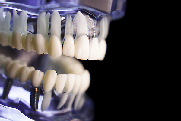 포토 JPG 해외이미지 모델 백그라운드 컨셉 해부 미래 건강 치과 사람없음 우주 침묵 시험 흰색 투명 닫기 치아 크리스탈 치과의사 거짓 고립 곰팡이 돌봄 해외포토 교육 컬러 의학 모션 병원 소리 의사 소화기관 광석 파일형식 이미지허브