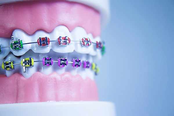 포토 JPG 해외이미지 치과 사람없음 치아 치아모형 틀니 위생관리 치아건강 치아교정 해외포토 건강 병원 관리 소화기관 교정 파일형식 이미지허브