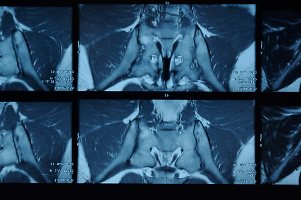 포토 JPG 해외이미지 엑스레이 건강 병원 사람없음 치료 사진촬영 시험 환자 의사 오르간 실험실 결과 질병 척추 뇌 뿌리 처방 암 테라피 골절 부정적 해골모형 해외포토 교육 감정 컨셉 의학 뼈 실험 뷰티 모형 촬영 의료진 건반악기 파일형식 이미지허브