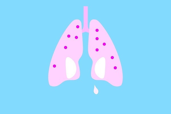 EPS 해외이미지 디자인 과학 백그라운드 컨셉 일러스트 해부 건강 사람 내부 약 고통 흰색 비행 얼룩 오르간 호흡기관 플랫 바이러스 질병 위험 심볼 눈물 생물학 감염 미생물 박테리아 전염병 해외일러스트 교육 감정 컬러 의학 생물 장기_의학 건반악기 파일형식 벡터 이미지허브