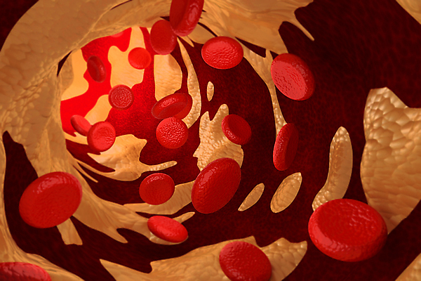 포토 JPG 해외이미지 세포 사람없음 3D 혈관 적혈구 혈구 동맥경화 해외포토 장기_의학 질병 디지털합성 파일형식 이미지허브