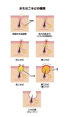 EPS 해외이미지 디자인 신체 일러스트 해부 세포 건강 사람 치료 흰색 질병 피부 생물학 분화구 문제 층 박테리아 끓이기 돌봄 해외일러스트 교육 컬러 의학 모션 신체부위 화산 파일형식 벡터 산 이미지허브