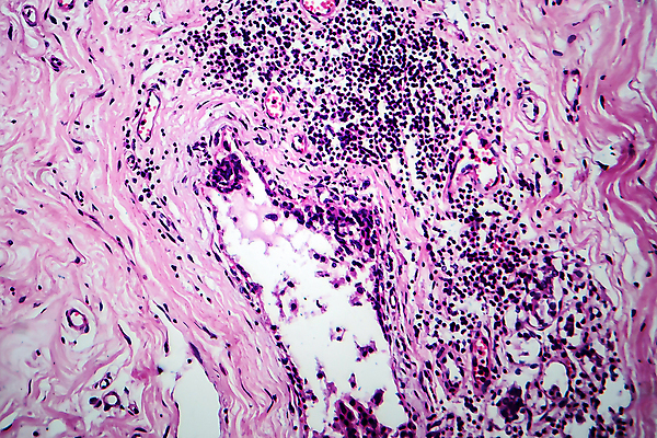 포토 JPG 해외이미지 여자 현미경 사람없음 약 얼룩 조직 변화 확대 질병 가슴 종양 해외포토 컨셉 의학 실험기구 사람 신체부위 파일형식 이미지허브