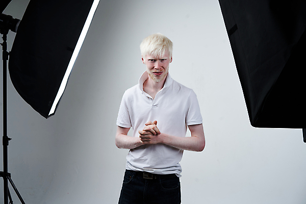 포토 JPG 해외이미지 모델 1 남자 얼굴 백그라운드 한명 사람 성인 빛 금발 흰색 표현 자신감 질병 발사 피부 방법 심각 우울증 재앙 적자 전문 특별함 해외포토 헤어스타일 감정 컬러 컨셉 의학 신체부위 파일형식 이미지허브