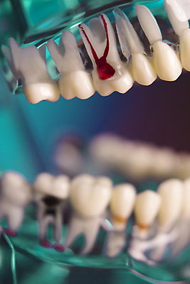 포토 JPG 해외이미지 모델 백그라운드 컨셉 해부 미래 건강 치과 사람없음 우주 침묵 시험 흰색 투명 닫기 치아 크리스탈 치과의사 거짓 고립 곰팡이 돌봄 해외포토 교육 컬러 의학 모션 병원 소리 의사 소화기관 광석 파일형식 이미지허브