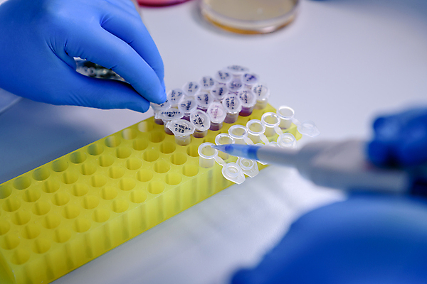 포토 JPG 해외이미지 과학 컨셉 건강 병원 실험 사람없음 스터디 약 장비 작업 액체 실험실 바이러스 질병 DNA 생명공학 플라스틱 약국 과학자 플라스크 분석 생물학 감염 미생물 튜브 발견 조제 혁명 개발 피펫 화학물질 화학자 살균 해외포토 직업 교육 의학 재질 생물 실험기구 학습 화학 만들기 학자 파일형식 이미지허브