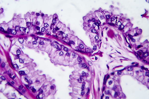포토 JPG 해외이미지 남자 현미경 사람없음 약 얼룩 조직 변화 확대 질병 암 종양 해외포토 컨셉 의학 실험기구 사람 파일형식 이미지허브