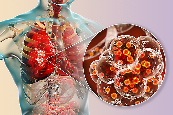 포토 JPG 해외이미지 과학 신체 일러스트 해부 현미경 사람 사람없음 글로벌 약 3D 중국 호흡기관 바이러스 질병 감염 테라피 백신 염증 전염병 해외일러스트 아시아 의학 실험기구 뷰티 장기_의학 디지털합성 파일형식 이미지허브