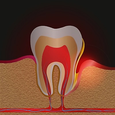 EPS 해외이미지 과학 일러스트 부분 해부 왕관 건강 치과 사람 치료 약 고통 입 구멍 치아 질병 치과의사 감염 뿌리 운하 문제 고립 돌봄 명패 썩음 위생관리 잇몸 해외일러스트 감정 신체 의학 모션 병원 관리 신체부위 의사 소화기관 파일형식 벡터 이미지허브