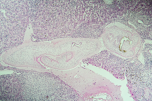 포토 JPG 해외이미지 과학 돋보기 열대 세포 사람없음 빨간색 약 조직 감염 썩음 해외포토 컬러 의학 파일형식 이미지허브
