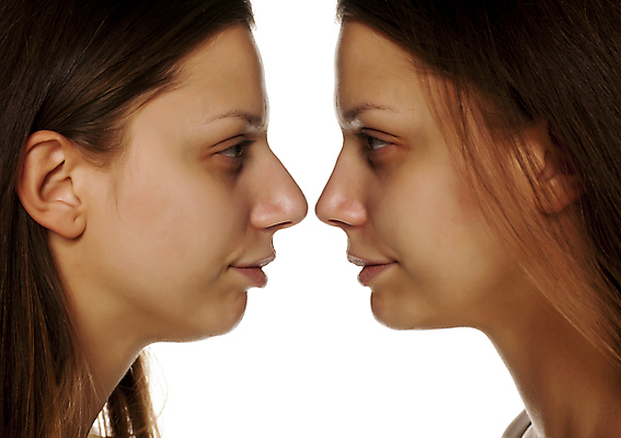 포토 JPG 해외이미지 여자 얼굴 백그라운드 컨셉 한명 옆모습 뷰티 약 화장품 흰색 비교 수술 보행로 플라스틱 코 외과 순서 고립 해외포토 1 길 뷰포인트 컬러 의학 재질 병원 사람 신체부위 치료 파일형식 이미지허브