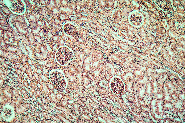 포토 JPG 해외이미지 과학 돋보기 세포 사람없음 파란색 약 조직 신장 질병 박테리아 해외포토 컬러 의학 비뇨기관 파일형식 이미지허브