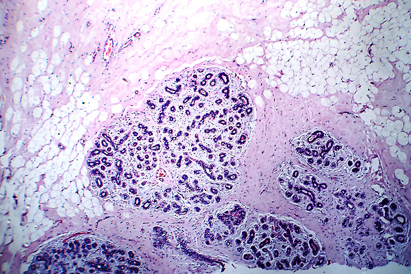포토 JPG 해외이미지 여자 현미경 사람없음 약 얼룩 조직 확대 질병 가슴 암 종양 해외포토 의학 실험기구 사람 신체부위 파일형식 이미지허브