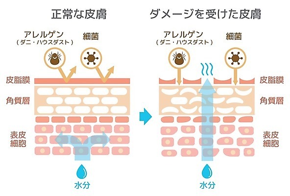 EPS 해외이미지 디자인 컨셉 신체 일러스트 비즈니스 부분 해부 학교 표면 세포 건강 사람 그래픽 치료 약 손상 감각 오르간 플랫 바이러스 보호 수분 피부 피부관리 그림 심플 층 박테리아 알레르기 고립 돌봄 엘리먼트 해외일러스트 교육 의학 모션 신체부위 뷰티 건반악기 질병 파일형식 벡터 이미지허브