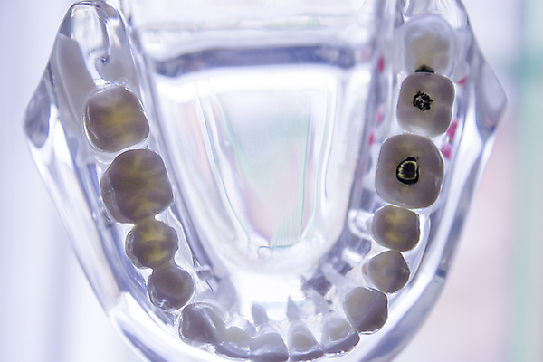 포토 JPG 해외이미지 모델 백그라운드 컨셉 해부 미래 건강 치과 사람없음 우주 시험 흰색 투명 닫기 치아 크리스탈 치과의사 거짓 고립 돌봄 해외포토 교육 컬러 의학 모션 병원 의사 소화기관 광석 파일형식 이미지허브