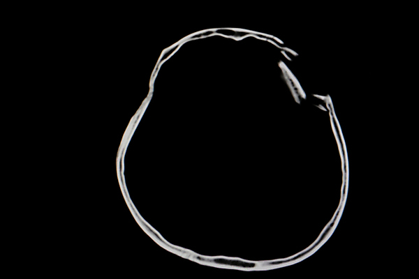 포토 JPG 해외이미지 백그라운드 신체 해부 뼈 골격 엑스레이 병원 사람 사람없음 컴퓨터 약 검은색 고통 환자 광선 흰색 긴급 수술 질병 X 사건 필름 뇌 외과 골절 돌봄 방사선 우울증 해골모형 해외포토 알파벳 감정 컬러 의학 모션 치료 전자제품 모형 파일형식 이미지허브